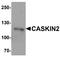 CASK Interacting Protein 2 antibody, A13821, Boster Biological Technology, Western Blot image 