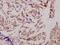 Death Inducer-Obliterator 1 antibody, A06019S186, Boster Biological Technology, Immunohistochemistry paraffin image 