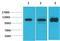 Voltage-dependent calcium channel subunit alpha-2/delta-2 antibody, A01560, Boster Biological Technology, Western Blot image 