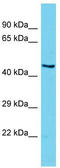 Divergent Protein Kinase Domain 2B antibody, TA331576, Origene, Western Blot image 