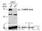 Calcium/Calmodulin Dependent Protein Kinase Kinase 2 antibody, GTX108305, GeneTex, Western Blot image 