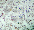 RB Transcriptional Corepressor 1 antibody, AP0444, ABclonal Technology, Immunohistochemistry paraffin image 