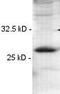 Synaptosomal-associated protein 23 antibody, ab4114, Abcam, Western Blot image 
