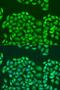 Survival Of Motor Neuron 2, Centromeric antibody, LS-C747617, Lifespan Biosciences, Immunofluorescence image 