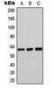 Tyrosine Hydroxylase antibody, MBS8241265, MyBioSource, Western Blot image 