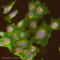 Integrin Subunit Beta 1 antibody, ab24693, Abcam, Immunocytochemistry image 
