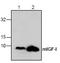 Insulin Like Growth Factor 1 antibody, TA319034, Origene, Western Blot image 