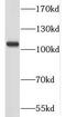 NLR Family Pyrin Domain Containing 2 antibody, FNab05758, FineTest, Western Blot image 