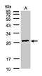 Glutathione S-transferase A2 antibody, LS-B11008, Lifespan Biosciences, Western Blot image 