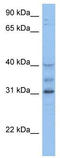 Homeobox D1 antibody, TA345386, Origene, Western Blot image 
