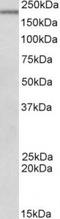 DENN Domain Containing 4C antibody, TA311611, Origene, Western Blot image 