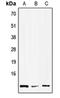 High Mobility Group Nucleosome Binding Domain 1 antibody, orb215476, Biorbyt, Western Blot image 