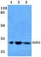 Uncoupling protein 2 antibody, PA5-36383, Invitrogen Antibodies, Western Blot image 