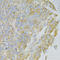 Moesin antibody, STJ114337, St John