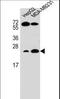 Ras Homolog Family Member J antibody, LS-C162598, Lifespan Biosciences, Western Blot image 