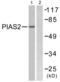 Protein Inhibitor Of Activated STAT 2 antibody, abx013224, Abbexa, Western Blot image 