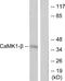Pregnancy Up-Regulated Nonubiquitous CaM Kinase antibody, A11515, Boster Biological Technology, Western Blot image 