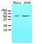 Kruppel Like Factor 4 antibody, AM09057PU-N, Origene, Western Blot image 