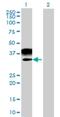 MAGE Family Member B2 antibody, H00004113-B01, Novus Biologicals, Western Blot image 