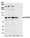Stromal interaction molecule 2 antibody, A304-429A, Bethyl Labs, Western Blot image 