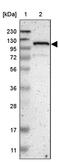 Zinc Finger And BTB Domain Containing 11 antibody, PA5-53302, Invitrogen Antibodies, Western Blot image 