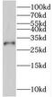 SSU72 Homolog, RNA Polymerase II CTD Phosphatase antibody, FNab08256, FineTest, Western Blot image 