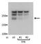Translocated Promoter Region, Nuclear Basket Protein antibody, NB100-2864, Novus Biologicals, Western Blot image 