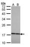 Crystallin Beta A4 antibody, PA5-22032, Invitrogen Antibodies, Western Blot image 