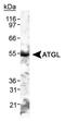 Adipose triglyceride lipase antibody, NB110-41536, Novus Biologicals, Western Blot image 