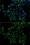 Fatty Acid Binding Protein 2 antibody, GTX53994, GeneTex, Immunofluorescence image 