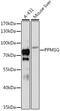 Protein Phosphatase, Mg2+/Mn2+ Dependent 1G antibody, LS-C747345, Lifespan Biosciences, Western Blot image 