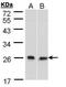 DnaJ Heat Shock Protein Family (Hsp40) Member B6 antibody, PA5-21401, Invitrogen Antibodies, Western Blot image 