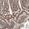 Mesoderm Development LRP Chaperone antibody, PA5-58781, Invitrogen Antibodies, Immunohistochemistry frozen image 