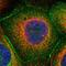 Tumor Protein P53 Binding Protein 2 antibody, HPA021603, Atlas Antibodies, Immunofluorescence image 