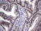 Histone Deacetylase 9 antibody, LS-C790573, Lifespan Biosciences, Immunohistochemistry paraffin image 