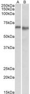 Protein Kinase AMP-Activated Catalytic Subunit Alpha 2 antibody, STJ72336, St John