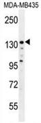 Zinc Finger E-Box Binding Homeobox 2 antibody, AP54642PU-N, Origene, Western Blot image 
