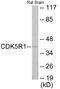 Cyclin Dependent Kinase 5 Regulatory Subunit 1 antibody, EKC1817, Boster Biological Technology, Western Blot image 