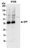 Histocompatibility Minor 13 antibody, NBP2-32276, Novus Biologicals, Immunoprecipitation image 