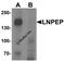 Leucyl And Cystinyl Aminopeptidase antibody, 7055, ProSci Inc, Western Blot image 
