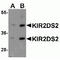 Killer cell immunoglobulin-like receptor 2DS2 antibody, TA349181, Origene, Western Blot image 