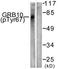 Growth factor receptor-bound protein 10 antibody, TA313962, Origene, Western Blot image 