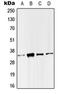 Single-strand selective monofunctional uracil DNA glycosylase antibody, LS-C353362, Lifespan Biosciences, Western Blot image 