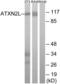 Ataxin 2 Like antibody, LS-C119748, Lifespan Biosciences, Western Blot image 