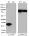 Nicotinamide N-Methyltransferase antibody, NBP2-00537, Novus Biologicals, Western Blot image 