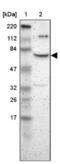 Zinc Finger With KRAB And SCAN Domains 8 antibody, NBP1-82840, Novus Biologicals, Western Blot image 