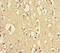 Dedicator Of Cytokinesis 6 antibody, LS-C677716, Lifespan Biosciences, Immunohistochemistry paraffin image 