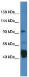 Janus Kinase And Microtubule Interacting Protein 2 antibody, TA343052, Origene, Western Blot image 