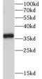 Thymidylate Synthetase antibody, FNab08681, FineTest, Western Blot image 