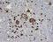 ACTH receptor antibody, orb10036, Biorbyt, Immunohistochemistry paraffin image 